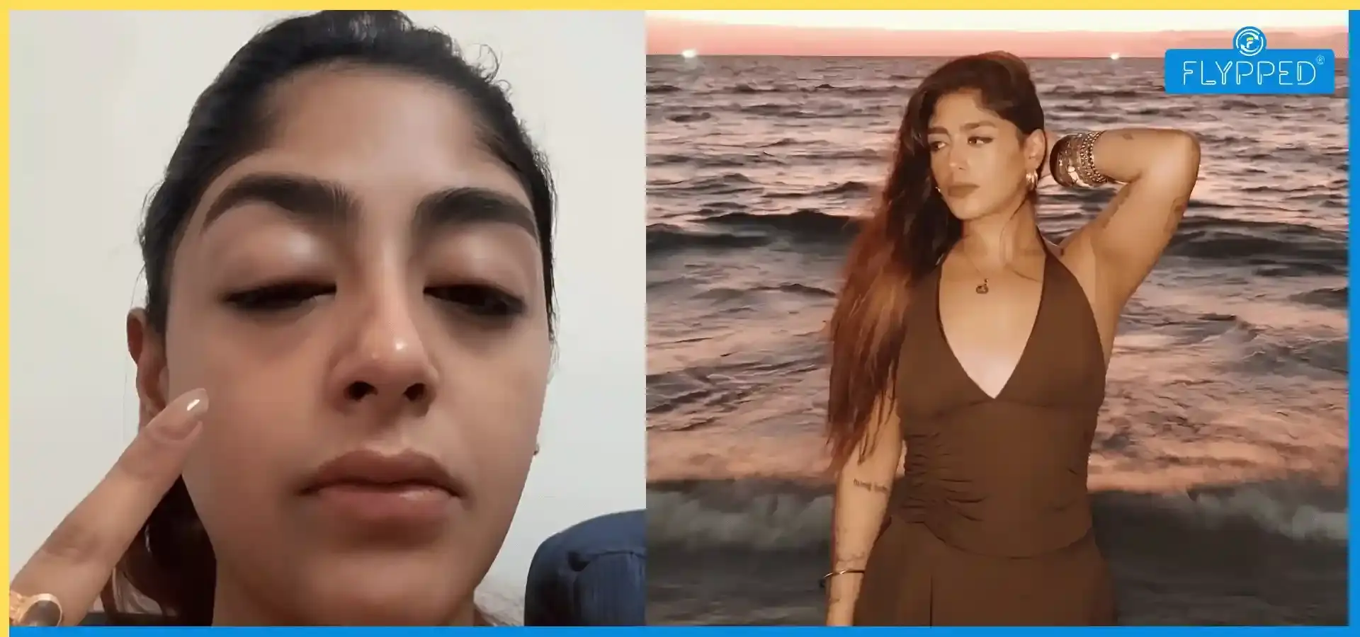 Preet Singh Assault! Splitsvilla 16 की कंटेस्टेंट पर हमला, आईं चोटें