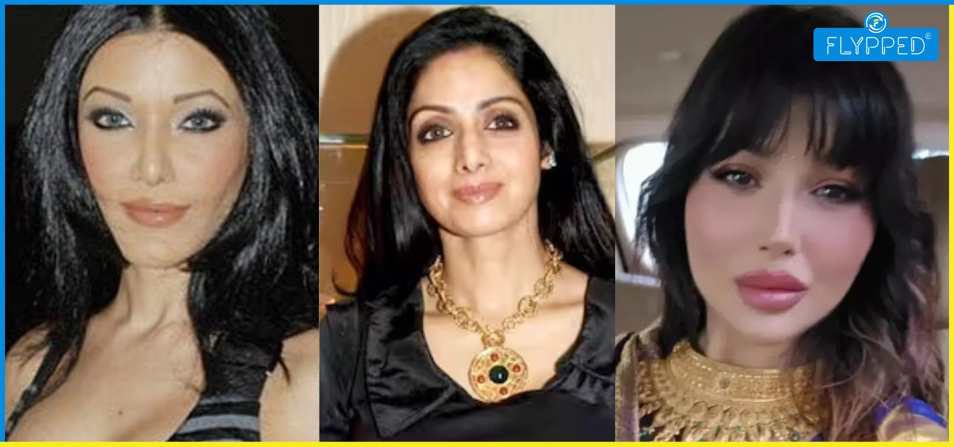 Top 10 Actresses: Surgery Gone Wrong – कौन-कौन और क्या हुआ