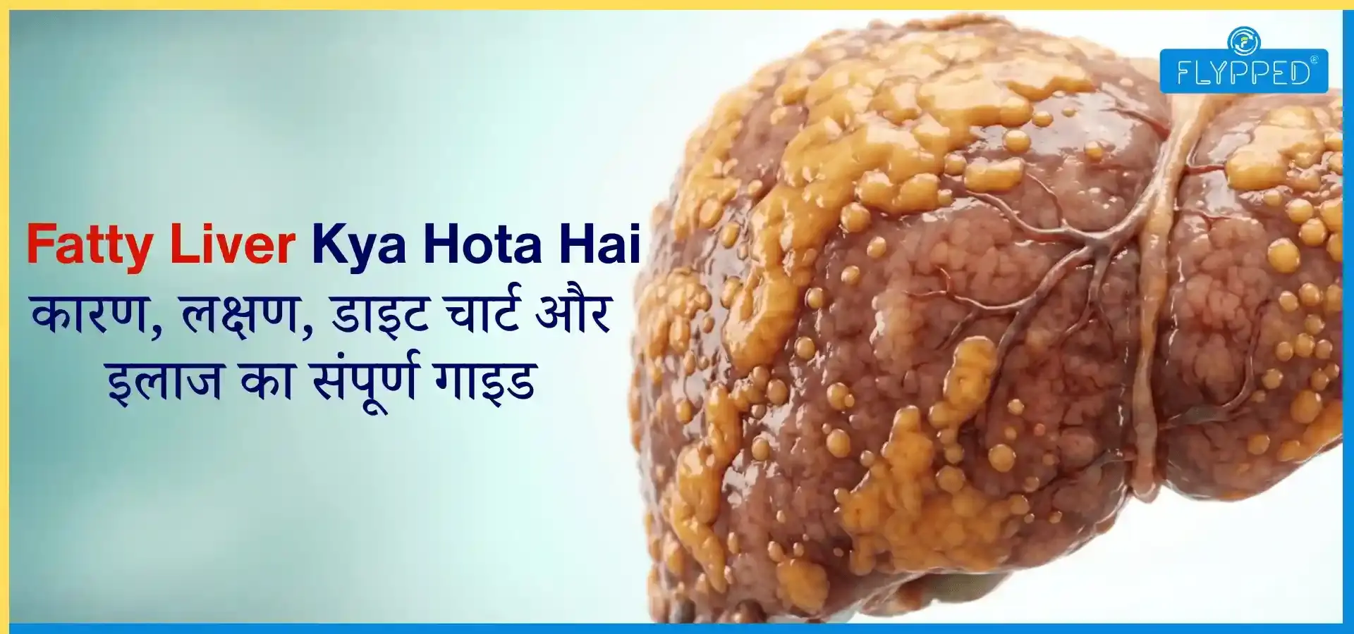 Fatty Liver Kya Hota Hai: कारण, लक्षण और पूरी जानकारी