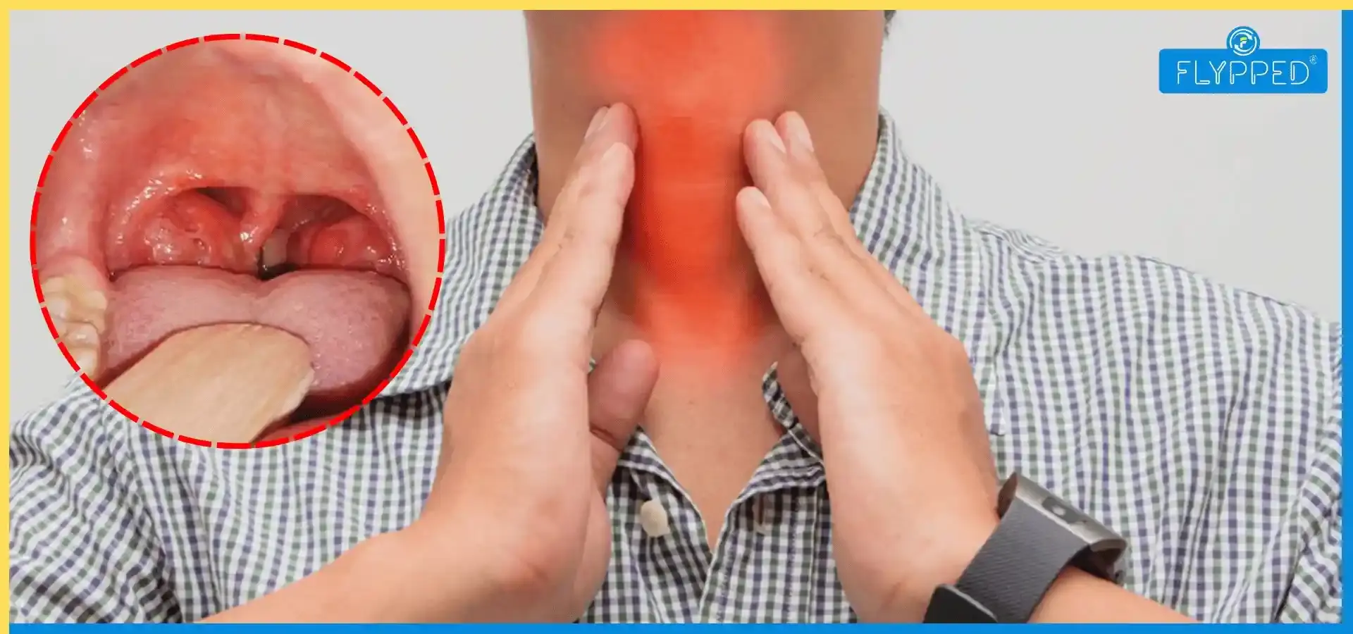 Tonsils Meaning in Hindi: लक्षण और ठीक करने के कुछ घरेलू उपाय