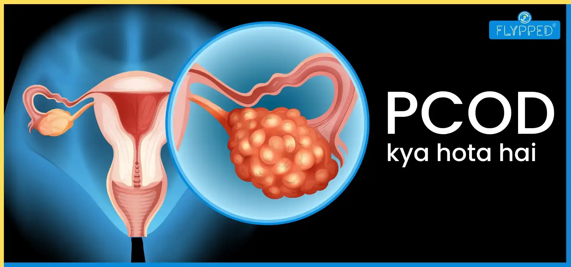 PCOD Kya Hota Hai? इसके लक्षण, इलाज और डाइट्स